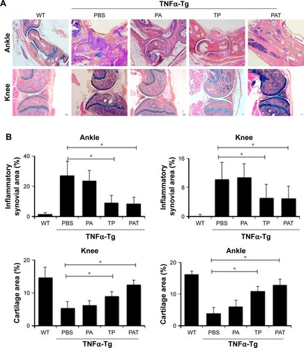 Figure 6 Both TP and PAT reduce ankle and knee joint tissue inflammatory damage in TNFα-Tg mice. (A) Representative ABOG-stained sections (magnification ×40) show decreased joint tissue damage, including decreased synovial inflammation and cartilage erosion in TP- and PAT-treated mouse. (B) Quantitation of inflammatory synovial tissue area percentage of ankle and knee joints, and cartilage area percentage of ankle and knee joints. Values are the mean ± SD of 7–10 legs per group. *P<0.05, compared with PBS treated group.Abbreviations: WT, wild type; TNFα-Tg, tumor necrosis factor α transgenic; PBS, phosphate buffer saline; PA, poly-γ-glutamic acid-grafted di-tert-butyl L-aspartate hydrochloride; TP, triptolide; PAT, TP-loaded poly-γ-glutamic acid-grafted di-tert-butyl L-aspartate hydrochloride; ABOG, Alcian blue/orange G.