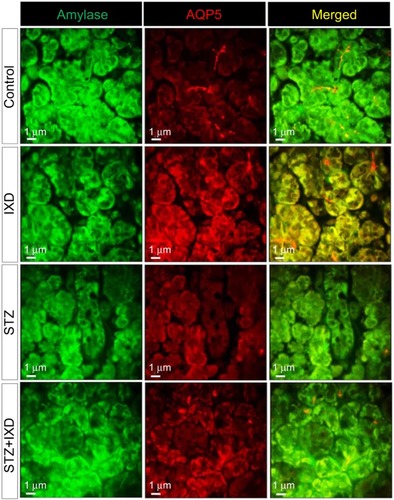 Figure 6 Confocal microscope images of immunofluorescence-detected α-amylase and AQP5 expression