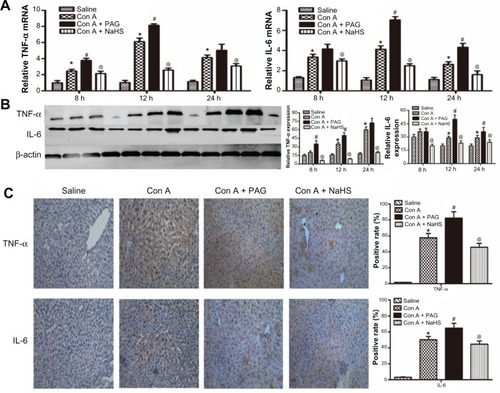 Figure 2 H2S pretreatment inhibits the release of cytokines during Con A-induced hepatitis.