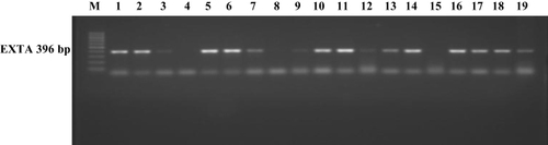 Figure 3 Representing positive pattern to Exotoxin A (EXTA) Lane M: DNA (ladder) marker (100b). These result showed a 396-bp PCR- Positive DNA for the samples in lanes 2, 3.4, 6, 7, 8, 10, 11, 12, 13, 14, 17, 18, 19 and negative in lanes 5, 9 and 16 that mean the P. aeruginosa have no Exotoxin A as virulence factors in those three isolates.