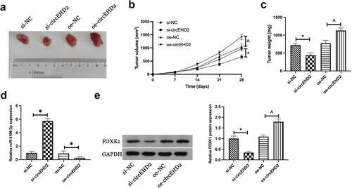 Figure 6. CircEHD2 motivates NSCLC tumor growth in vivo.