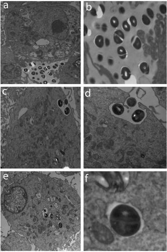 Figure 3. The PHSF cells were challenged withS. haemolyticus at an MOI of 10 and examined with TEM. (a) After 15 min of infection, extracellular bacteria were observed (3600x) which were further magnified (14,000 x) in (b). (c) After 1 h of infection, bacteria invaded the cells and became engulfed (3600 x). (d) Initialization of phagocytosis. (e) After 90 min, S. haemolyticus entered the PHSF cells and become localized in vacuoles (3600 x). (f) Proliferating bacteria are shown inside the vacuole.