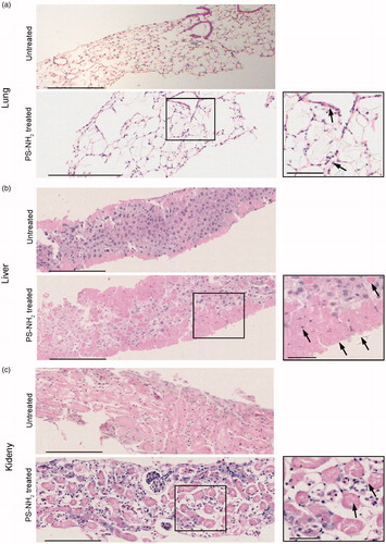 Figure 2. Morphological assessment of murine lung, liver, and kidney slices exposed to PS-NH2 nanoparticles. Tissue morphology after 48 h of lung (a), liver (b), and kidney (c) untreated slices and slices exposed to 50 µg/mL PS-NH2. Cross sections of tissue slices were imaged after hematoxylin and eosin staining. Scale bar: 200 µm for left side images and 50 µm for zoomed details on the right. Exposure to PS-NH2 led to decreased viability in all organs and severely damaged morphology. In the lung slices exposed to the nanoparticles (a), severe damage to the alveoli was visible, together with apoptotic bodies (shown by the arrows). In the liver (b), tissue damage was visible mainly in the outer cell layers, including anucleated cells, apoptotic bodies, and apoptotic cell debris (as indicated for some examples by the arrows). In the kidneys (c), severe damage was visible throughout all tissue section with severe nuclear dissolution especially on proximal tubuli and necrotic tissue (see arrows for some examples).