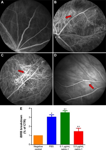 Figure 6 Effect of netrin-1 on retinal vascular leakage and iBRB breakdown of STZ-induced diabetic rats.