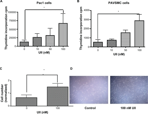 Figure 6 Urotensin II-induced cellular proliferation in a dose-dependent manner. 3H-thymidine uptake in A. Pac1 and B. PAVSMC treated with urotensin II in a dose-dependent manner stimulates proliferation (n = 4, *P ≤ 0.01). C) Cell counting was used as a measure of cellular proliferation in Pac. Experiment was blinded and six independent experiments were conducted with triplicates (n = 18, *P ≤ 0.05). D) A representative image of control and 100 nM urotensin II (image 20 × objective) in Pac1.