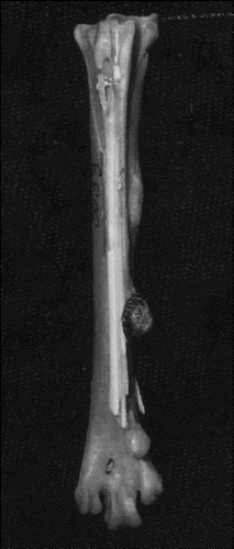 Figure 4. Posterior view of Bateleur eagle (Terathopius ecaudatus) metatarsus. Prominent mid diaphyseal bump, related to neoplasm.