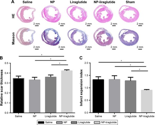 Figure 5 Morphological analysis.Notes: Morphological analysis of the left ventricle among the different groups. (A) Representative H&E staining and Masson’s trichrome staining. Scale bars, 2 mm. Quantification of the relative scar thickness (B) and infarct expansion index (C) based on Masson’s trichrome staining. Data are shown as mean ± SEM, *P<0.05. NP-liraglutide: liraglutide loaded in PLGA–PEG NPs.Abbreviations: NP, nanoparticle; PEG, poly(ethylene glycol); PLGA, poly(lactic-co-glycolic acid); SEM, standard error of the mean.