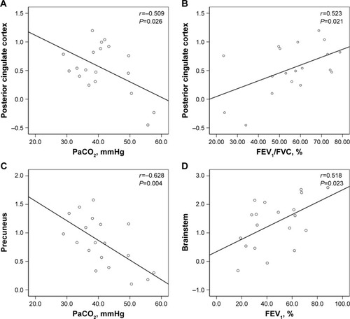 Figure 5 Significant correlation was observed between the ALFF values in the PCC (A, B), precuneus (C), brainstem (D) and the clinical parameters (PaCO2, FEV1/FVC, and FEV1) in the stable COPD patient group.