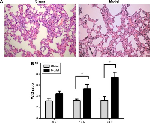 Figure 1 The effect of SAP on lung tissue.