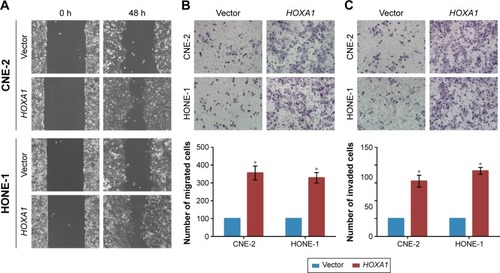 Figure 6 HOXA1 is involved in miR-99a-mediated nasopharyngeal carcinoma cell migration and invasion.