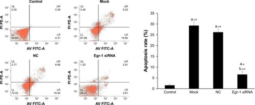 Figure 4 Effects of As2O3 combined with AZT on cell apoptosis.