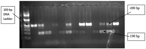 Figure 2 Agarose gel (2 %) electrophoresis showing PCR products of the ACE I/D gene.