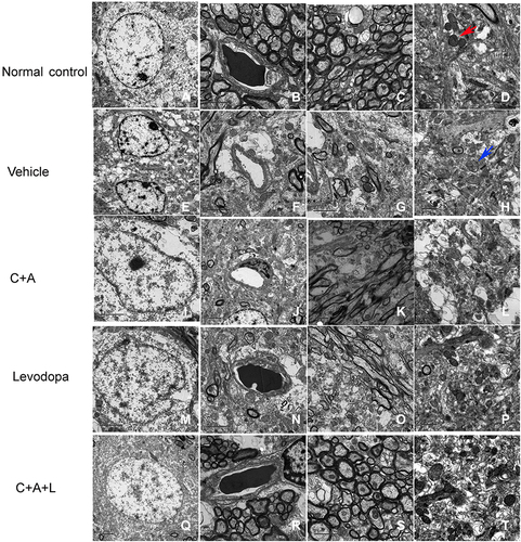 Figure 10 Ultrastructural morphology using TEM. (A–D) control; (E–H) MPTP; (I–L) MPTP and C16+Ang-1; (M–P) MPTP and levodopa; (Q–T) MPTP and C+A+L. Mitochondria with clear cristae are shown by the red arrow. Mitochondria vacuolization and swollen cristae are shown by the blue arrow. A-C, E-G, I-K, M-O, Q-S, Scale bar = 2 μm; D, H, L, P, T, Scale bar = 1 μm.