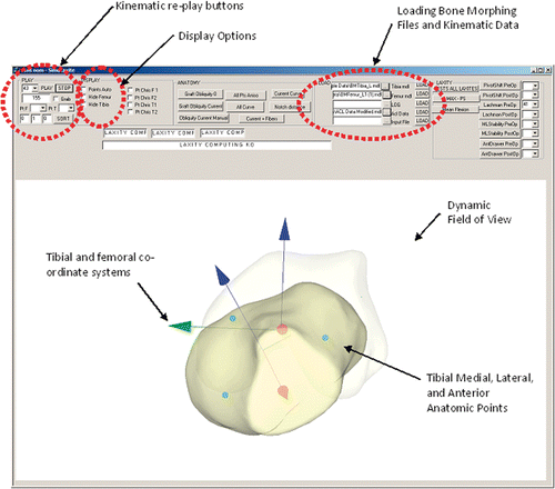 Figure 2. Screenshot of the Pivot Shift Visualizer interface. Once the bone morphing and kinematic data files are loaded, the program displays a 3D rendering of the tibia and the femur, along with a coordinate system. The user may then replay the tibiofemoral motion recorded by the navigation system during the pivot shift test.