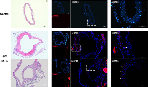 Figure 6 Immunohistochemical findings. H&E staining and CD11b immunofluorescence staining of AA. Control group: H&E staining showed no aortic dilation and the absence of immunofluorescence. Experimental group: H&E staining showed aorta dilation compared with the control group. Immunofluorescence staining showed infiltration of CD11b-positive cells (white arrows).