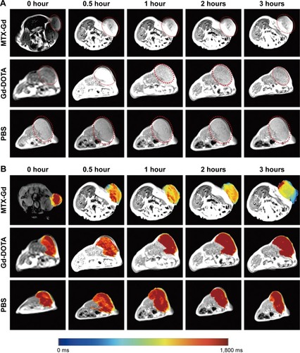 Figure 5 (A) T1-weighted images and (B) the corresponding mapping images of tumors after injection of MTX-Gd, Gd-DOTA, and PBS at different time points. (C) T1-mapping values of tumors were measured after different injection times of MTX-Gd (*P<0.05, **P<0.005).