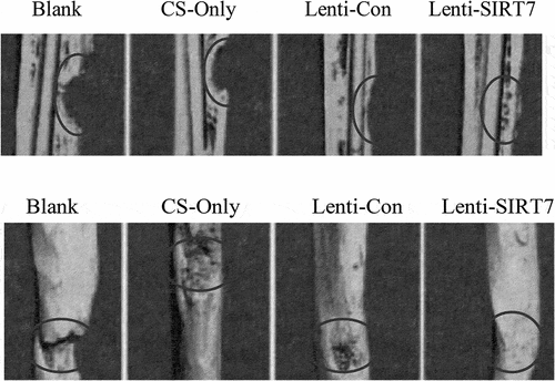 Figure 7. Missing surface and reconstructed image of Micro-CTD (Blank: blank group; CS-Only: chitosan scaffold group; Lenti-con: control group; Lenti-SIRT7: knockout SIRT7 group. The circle shows the degree of bone defect.).