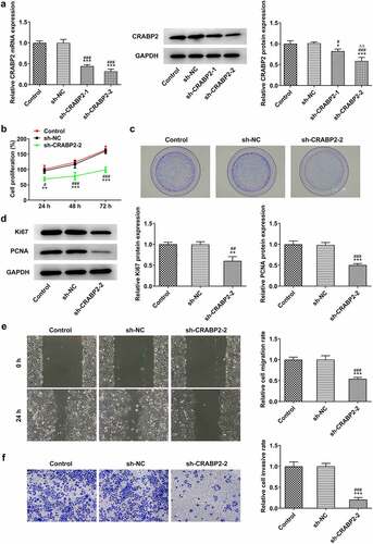 Figure 2. CRABP2 knockdown inhibits proliferation, invasion and migration of RB cells. (a) CRABP2 mRNA and protein expression in WERI-RB1 transfected with sh-CRABP2-1/2 were respectively detected by RT-qPCR analysis and Western blot. *P < 0.05 and ***P < 0.001 vs. control group. #P < 0.05 and ###P < 0.001 vs. sh-NC group. ∆∆P < 0.01 vs. sh-CRABP2-1 group. (b) The proliferation and (c) colon formation ability of WERI-RB1 transfected with sh-CRABP2-2 was analyzed by CCK-8 and colon formation assay. (d) The expression of proliferation related proteins (Ki67 and PCNA) in WERI-RB1 transfected with sh-CRABP2-2 was determined by Western blot. (e) The migration and (f) invasion of WERI-RB1 transfected with sh-CRABP2-2 was analyzed by wound healing and transwell assay. **P < 0.01 and ***P < 0.001 vs. control group. #P < 0.05, ##P < 0.01 and ###P < 0.001 vs. sh-NC group.