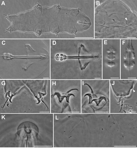 Figure 1. Ramazzottius kretschmanni sp. nov. (LM). A. In toto (ventral view). B. Elliptical organs on the head (arrowhead = pores). C-D. Feeding apparatus. D. Feeding apparatus (in focus the dorso-lateral macroplacoids). E. Macroplacoids (dorsal view). F. Macroplacoids (lateral view). G. Hind legs. H. Claws of II leg. I. Claws of III leg. J. Hind leg (arrowhead = gibbosity). K. Sensory area around mouth opening (COS). L. Posterior-dorsal cuticle. A, C, E, F, H, I, L: holotype. A, B, D, G-L: PhC. C, E, F: DIC. Scale bars: A, L = 50 µm; B-D, G-K = 10 µm; E, F = 5 µm.