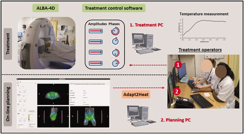 Figure 2. Situation during a hyperthermia treatment, where Adapt2Heat is used as an assistance tool. There is no direct connection between Adapt2Heat and the treatment control software, which avoids any risk of inadvertently affecting the actual treatment when using the treatment planning. The operators remain responsible for changing the system settings via the treatment control software.