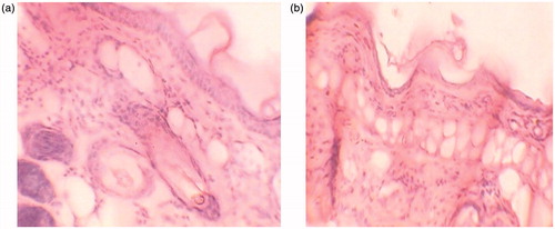 Figure 17. (a) Mice ear after P. acnes injection (b) mice ear after four days treatment with NG.