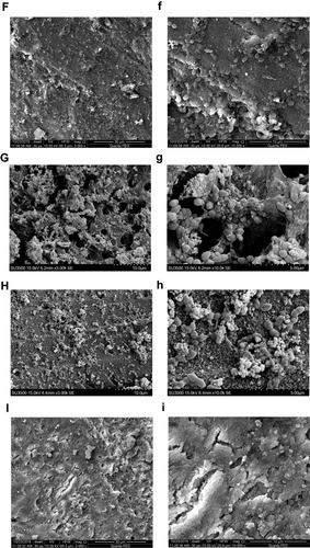 Figure 5 Representative E. faecalis biofilms (4-week old) on dentin surface after medication were scanned by SEM or FE-SEM (capital letters: ×3000 magnification; small letters: ×10,000 magnification).Notes: (A and a) Negative control group; (B and b) CH group; (C and c) MTA group; (D and d) MCSNs group; (E and e) Ag-MCSNs group; (F and f) Zn-MCSNs group; (G and g) Ag/Zn(1:9)-MCSNs group; (H and h) Ag/Zn(1:1)-MCSNs group; (I and i) Ag/Zn(9:1)-MCSNs group.Abbreviations: SEM, scanning electron microscopy; FE-SEM, field emission scanning electron microscopy; CH, calcium hydroxide; MTA, mineral trioxide aggregate; MCSNs, mesoporous calcium-silicate nanoparticles; Ag-MCSNs, nanosilver-incorporated MCSNs; Ag/Zn-MCSNs, nanosilver- and nanozinc-incorporated MCSNs; Zn-MCSNs, nanozinc-incorporated MCSNs.