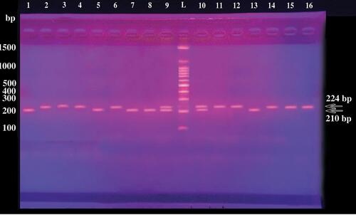 Figure 1 Gel electrophoresis of PCR products demonstrating different HLA-G genotypes of the studied participants. Lane L: 100-bp DNA Ladder; lanes 2, 3, 4, 6, 11, 12, 14, 15, 16: HLA-G homozygotes ins/ins (+14bp/+14bp); lanes 9,10: HLA-G heterozygotes ins/del (+14bp/-14bp); lanes 1, 5, 7, 8,13: HLA-G homozygotes del/del (−14bp/-14bp). Depending upon the insertion or deletion of 14 bp sequence in HLA‐G exon 8, PCR products of length 224 or 210 bp were generated, respectively. Three different genotypes homozygous for 14 bp insertion [ins/ins] (+/+14 bp) 224 bp, homozygous for 14 bp deletion [del/del] (−/−14 bp) 210 bp and heterozygous for 14 bp insertion/deletion [ins/del] (+/−14 bp) 224 bp and 210 bp were generated.