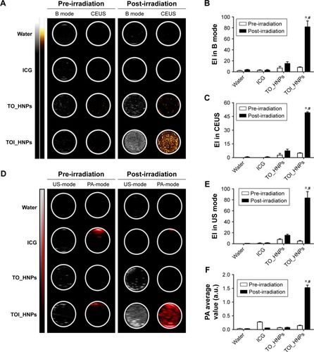 Figure 3 Dual-mode imaging in vitro agar-gel model.Notes: (A) B mode and CEUS imaging of particles before and after laser irradiation for degassed water, free ICG, TO_HNPs, and TOI_HNPs. (B, C) The semi-quantitative of EI in B mode and CEUS before and after laser irradiation. (D) US mode and PA mode imaging for the same groups before and after laser irradiation. (E, F) The semi-quantitative of EI in US mode and PA average value in PA mode before and after laser irradiation. TOI_HNPs of post-irradiation compared with the pre-irradiation, *P<0.05; after laser irradiation, TOI_HNPs compared with the other groups at the same conditions, #P<0.05.Abbreviations: CEUS, contrast-enhanced ultrasound; EI, echo intensity; ICG, indocyanine green; LPHNPs, lipid–polymer hybrid nanoparticles; PFP, perfluoropentane; TOI_HNPs, folate-targeted LPHNPs-loaded ICG/PFP-carrying oxygen; US, ultrasound; TO_HNPs, folate-targeted LPHNPs-loaded PFP-carrying oxygen.