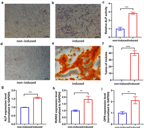 Figure 1. Osteogenic differentiation of hUCMSCs. Cultures were either induced to undergo osteogenic differentiation (‘induced’) or not (‘non-induced’). (a-b) ALP staining on day 7. (c) Semi-quantitative analysis of ALP activity on day 7. (d-e) Alizarin red staining on day 21. (f) Semi-quantitative analysis of calcium nodule deposition on day 21. (g-i) Expression levels of the osteogenesis-related markers ALP, RUNX2, and OPN on day 7. **P < 0.01, ***P < 0.001, ****P < 0.0001.