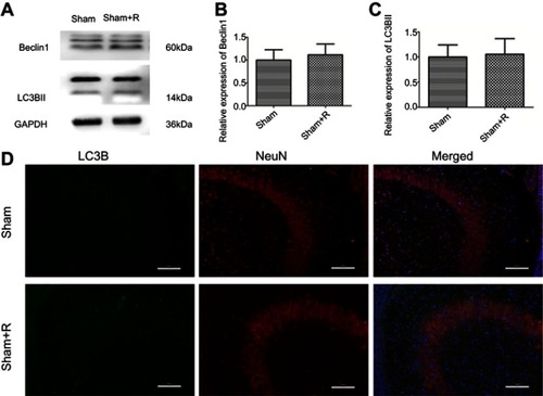 Figure S1 Autophagy markers expression levels in sham and sham + R groups. Representative western blots (A) and quantification of (B) Beclin1 and (C) LC3B-II, values are presented as mean±SD (n=6/group). (D) Representative immunofluorescent staining of LC3B (green) with NeuN (red) in hippocampus, scale bar =100 μm.