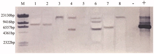 Figure 4. Southern blot analysis of transformants of T. fuciformis YLCs. Genomic DNA isolated from hygromycin-resistant transformants (10 μg) was digested with XhoIand probed with a fragment of the hph gene. M: λ-Hind III digest DNA marker (Takara, Japan); −: wild-type T. fuciformis strain Y32 (negative control); +: vector pGEH (positive control); 1–8: hygromycin-resistant transformants.