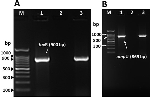 Figure 1 (A) PCR analysis for toxR gene of genomic DNA of V. cholerae non-O1/O139 strain isolated from urine specimen. Lane M, 100 base pair (bp) DNA ladder; lane 1, V. cholerae O1 Ogawa-Classical NIH41 (positive control for toxR gene); lane 2, negative control; lane 3, V. cholerae non-O1/O139 strain isolated from urine specimen. (B) PCR analysis for ompU gene of genomic DNA of V. cholerae non-O1/O139 strain isolated from urine specimen. Lane M, 100 base pair (bp) DNA ladder; lane 1, V. cholerae O1 Ogawa-Classical NIH41 (positive control for ompU gene); lane 2, negative control; lane 3, V. cholerae non-O1/O139 strain isolated from urine specimen.