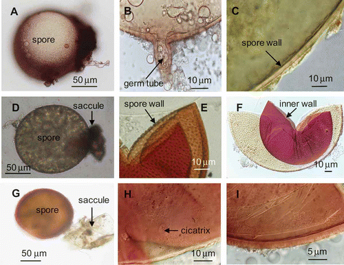 Figure 1. Morphological characteristics of the three dominant arbuscular mycorrhizal fungi. A–C, Glomus mosseae, D–F, Acaulospora scrobiculata, G–I, Acaulospora laevis.