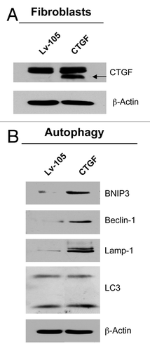 Figure 1. CTGF overexpression induces an autophagy/mitophagy program in fibroblasts. (A) Fibroblasts were stably-transfected with a CTGF or Lv-105 empty vector plasmid, using a lentiviral vector approach. Total proteins were isolated from transfected fibroblasts, and analyzed by immunoblotting to confirm CTGF expression. (B) Immunoblot analysis shows that CTGF overexpression induces the activation of autophagy/mitophagy in fibroblasts, as judged by increased expression levels of BNIP3, Beclin-1, Lamp-1 and LC3, as compared with control cells. The expression of β-actin was assessed for equal protein loading.