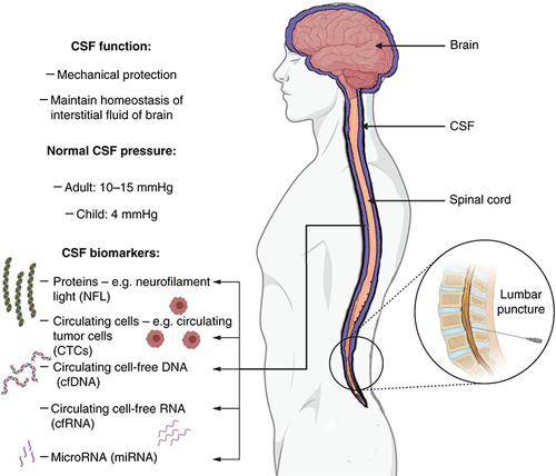 Figure 1. Overview of cerebrospinal fluid pathophysiology.