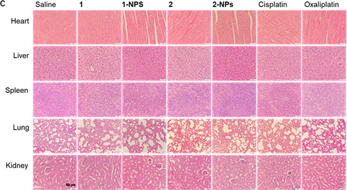 Figure 5 In vivo toxicities of tested compounds and nanoparticles to BALB/c mice. (A) The body weight of the mice during the treatment. (B) Drug accumulation in liver and kidney. (C) The H&E staining of slices from heart, liver, spleen, lung and kidney.