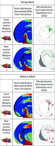 Fig. 4. MPS distribution fringe plots (normalized MPS values of 1 or smaller in blue, values of 1.5 or higher in red) at front and rear coronal sections from simulated rotational trauma with young adult (above) and mature adult (below) material properties in comparison to schemes showing DAI injury distribution from experiments with young adult and mature adult rats (Davidsson et al. 2015).