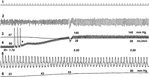 Figure 1. Influence of an injection of adrenaline into the ICA on the recorded variables (ascending phase): (Citation1) time indicator, (Citation2) amplitude of pial artery pulsation (NIR-T/BSS), (Citation3) blood flow in the left ICA (mL/min), (Citation4) mean BP ( mmHg), (Citation5) respiration, (Citation6) BP in the centripetal portion of the right ICA (mmHg). Initial vasoconstriction, seen as a decrease in pial artery pulsation, which represents the direct response to NE, is followed by passive transmission, seen as an increase in pial artery pulsation, when the BP exceeds the upper autoregulatory limit in the rabbit. Blood flow in the ICA remains diminished. Adapted with permission from Reference 24.