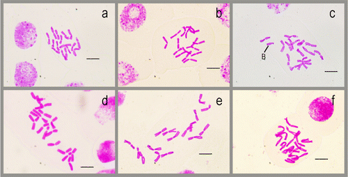 Figure 1 Somatic chromosomes in the studied taxa. (a) Allium arlgirdense; (b) A. anacoleum; (c) A. microspathum; (d) A. rhetoreanum; (e) A. shirnakense; (f) A. oreophilum. Scale bars 10 μm.