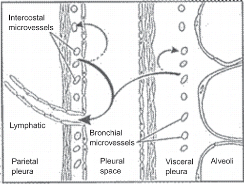 FIGURE 1. Fluid turnover and lymphatic drainage from the pleural space. In the normal pleural space (shown here), as in other interstitial spaces of the body, liquid slowly filters from systemic capillaries and is absorbed via lymphatics (solid arrows). In the pleural space, the capillary filtrate from systemic capillaries moves across a permeable pleural membrane toward the lower pressure pleural space and is absorbed via the parietal pleural lymphatics. From there, liquid moves via lymphatic propulsion to the central veins. When interstitial edema forms in the adjacent lung, some of that excess liquid moves across the visceral pleura into the pleural space. Asbestos fibers may follow similar routes from the lung to the pleura and are thought to lodge in the parietal pleura preferentially at sites of lymphatic drainage.