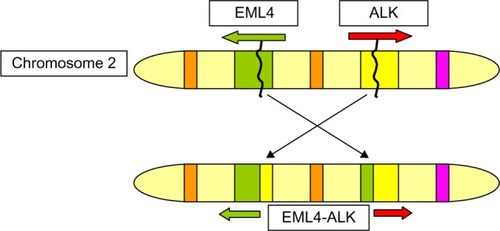 Figure 1 A chromosomal inversion in chromosome 2 juxtaposes the 5′ end of the EML4 gene with the 3′ end of the ALK gene resulting in the fusion oncogene EML4-ALK.