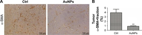 Figure 4 AuNPs reduced α-SMA-positive CAF density in SW620 tumor.Notes: (A) Histologic imaging illustrating the effect of AuNPs on the level of α-SMA-positive CAFs (brown) in tumor tissues. Scale bar, 100 µm. (B) Immunohistochemical analysis showed that the administration of AuNPs diminished the α-SMA-positive CAF density in SW620 tumor (n=6, **P=0.0032, Student’s t-test). Error bars indicate SEM.Abbreviations: AuNPs, gold nanoparticles; α-SMA; alpha-smooth muscle actin; CAFs, cancer-associated fibroblasts; Ctrl, control; SEM, standard error of the mean.