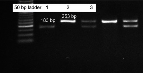 Figure 2 Agarose gel electrophoresis showing different VNTR genotypes in the IL-4 gene. The size of the bands was determined through comparison to a 50 bp ladder. Lane 1 represents the 1R\1R genotype, with one band at 183 bp; lane 2 contains the 2R\2R genotype, as indicated by one band at 253 bp. On the other hand, the heterozygous genotype 1R\2R is represented by lane 3 (two bands with sizes of 183 bp and 253 bp, respectively).