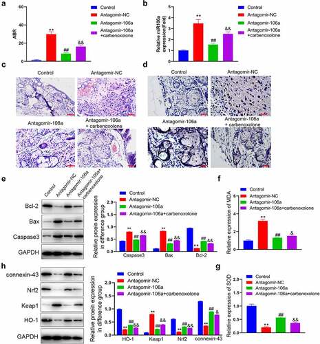 Figure 6. Pathological state and the level of oxidative stress in SNHL rats were alleviated by antagomir-106a. SNHL rats were administered with antagomir-NC, antagomir-106a, or antagomir-106a combined with carbenoxolone, respectively. A. The ABR values were recorded. B. The level of miRNA106a in SNHL rats was detected by RT-PCR. C. The pathological changes in cochlea tissues were determined by HE staining. D. The apoptosis in cochlea tissues was evaluated by the TUNEL assay. E. The level of Bcl-2, Bax, and caspase-3 was evaluated by the Western blotting assay. F. The concentration of MDA was measured using the commercial kit. G. The concentration of SOD was measured using the commercial kit.H. The expression level of Nrf2, Keap1, and HO-1 was evaluated by the Western blotting assay (**p < 0.01 vs. control, ##p < 0.01 vs. antagomir-NC, & p < 0.05 vs. antagomir-106a, && p < 0.01 vs. antagomir-106a). Scale bar: 100 μm.