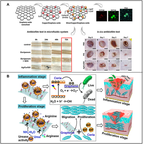 Figure 6 (A) Preparation of silver/copper/graphene oxide nanocomposites and their antibacterial film effect and promotion of wound healing after Pseudomonas aeruginosa infection. Reproduced with permission from: Jang J, Lee JM, Oh SB, Choi Y, Jung HS, Choi J. Development of Antibiofilm Nanocomposites: Ag/Cu Bimetallic Nanoparticles Synthesized on the Surface of Graphene Oxide Nanosheets. ACS Appl Mater Interfaces. 2020;12(32):35826–35834. doi: 10.1021/acsami.0c06054.Citation203 Copyright © 2020, American Chemical Society. (B) Schematic diagram of the wound healing mechanism of arginine-loaded and detachable ceria-graphene nanocomposites (ACG NCS). Reproduced with permission from: Cheng Y, Chang Y, Feng Y, et al. Hierarchical acceleration of wound healing through intelligent nanosystem to promote multiple stages. ACS Appl Mater Interfaces. 2019;11(37):33725–33733. doi:10.1021/acsami.9b13267.Citation204 Copyright © 2019, American Chemical Society.