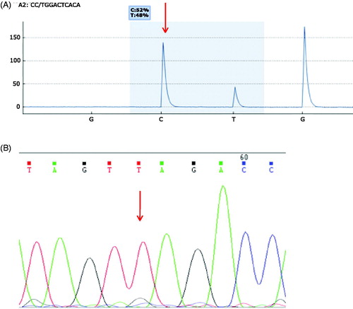 Figure 3. Additional mutations of interest. (A) A Pro96Leu mutation (C->T) in SRSF2 in patient 10 was confirmed by pyrosequencing showing a frequency of 48%. (B) Sanger sequencing confirmation of the Gln821Ter (CAG->TAG) TET2 mutation in patient 5 which results in termination of the protein.