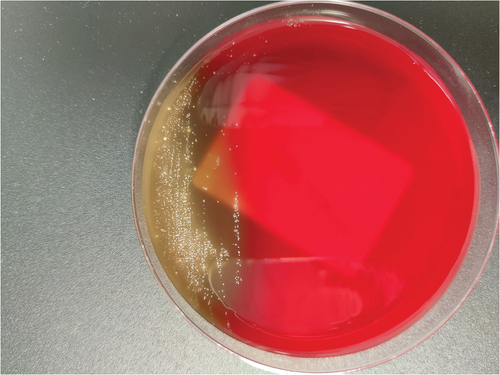 Figure 3. Culture on anaerobic medium (schaedler agar) from intraoperative specimens collected during fasciotomy of the leg.