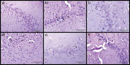 Figure 7. Photomicrographs of cerebrum: a) Control group, b) Model group, c) Donepezil, d) CA 200, e) CA 400 and f) CA 800. H & E stain, magnification 40x, n = 3. Focal gliosis in the cerebral cortex with different severity (black arrows).