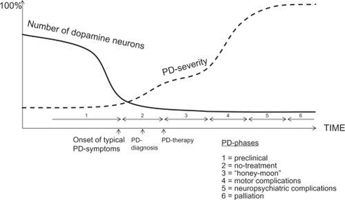 Figure 1 Schematic view of PD progression and its different stages.