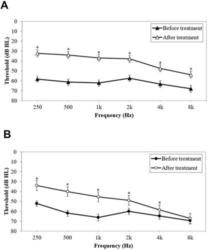 Figure 1 The hearing thresholds of the idiopathic sudden sensorineural hearing loss ear in patients with obstructive sleep apnea (OSA) (B) and patients without OSA (A) before and after treatment. *P<0.05; a statistically significant Wilcoxon signed-rank test; b statistically significant paired t-test.